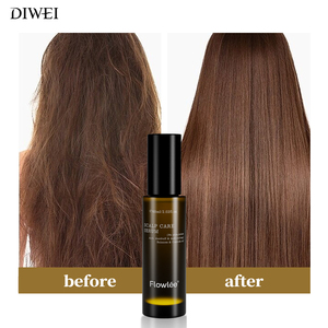 Diwei <span class=keywords><strong>disaar</strong></span> สเปรย์ปลูกผมสำหรับผู้ชายน้ำมันบำรุงผมร่วงยี่ห้อดีเหว่ยสำหรับผู้หญิง - Product Image 1