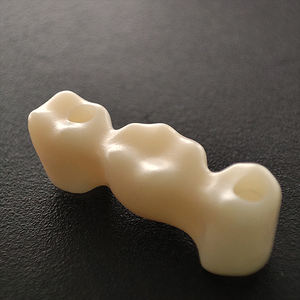 <span class=keywords><strong>Implants</strong></span> <span class=keywords><strong>dentaires</strong></span> de haute qualité à bas prix avec couronne <span class=keywords><strong>en</strong></span> <span class=keywords><strong>zircone</strong></span> et dents de pont Livraison rapide du fabricant chinois - Product Image 6