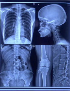 Película Térmica Médica PET Mate para CR, <span class=keywords><strong>DR</strong></span>, CT, MRI, etc., en Tamaños A4, A3, 8''x10'', 10''x12'', 11''x14'', 14''x17'', Venta de Fábrica - Product Image 1