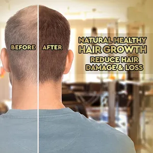 Private Label Serum Growth Hair Treatment Scalp Care Hair Growth Loss Serum Custom Logo Hair Growth Serum With Derma Roller