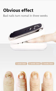 Nagelpilz-Lösung Fuß-Laser-LED-Licht-Massagegerät mit Zeitsteuerung für Beschädigte Verfärbte Dicke Nägel - Product Image 2