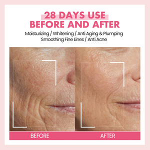 5 ב 1 טיפוח העור מוצרי עור מולטי רטינול ויטמין c הלבנה אנטי אייג 'ינג להפחית קמטים עור הפנים הסרום תווית פרטית - Product Image 6