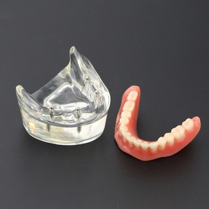 Modello di denti dentali di restauro di Overdenture di vendita calda/modello di studio dentale - Product Image 2