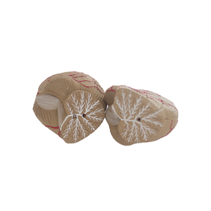 Y tế mô hình động mạch não người có thể tháo rời kích thước người lớn Mô hình giải phẫu động mạch não nâng cao bức tranh mô hình giải phẫu não người - Product Image 6