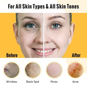 Private Label <strong>Vitamin</strong> C Whiten Serum Anti <strong>Aging</strong> Natural Organic Whitening Brightening Anti Wrinkle With 20% Face <strong>Vitamin</strong> C Serum - Product Image 5