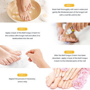 2025 Popular Método de uso simple Recuperación rápida de la salud de las uñas Crema reparadora de uñas dañadas - Product Image 4