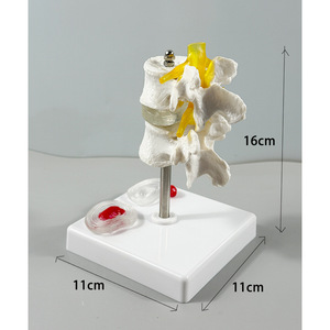 Modelo Anatómico de Disco Intervertebral Lumbar Humano Fabricado por MAXCARE, Modelo de Esqueleto de Ciencia Médica de ABS/PVC - Product Image 3