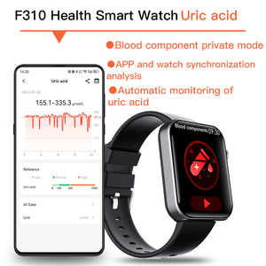 Bán buôn <span class=keywords><strong>ECG</strong></span> thông minh đồng hồ Pro với Y Tế cấp <span class=keywords><strong>ECG</strong></span> phân tích 24h nhịp tim ngủ giám sát oxy máu Nhà cung cấp - Product Image 5