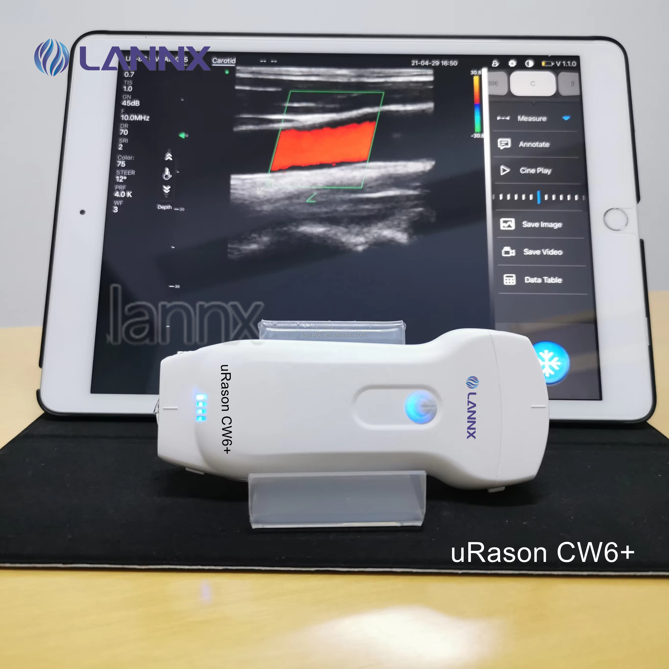 ultrasound head