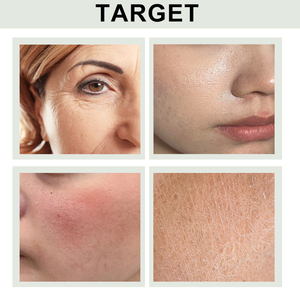 Soins de la peau <span class=keywords><strong>bio</strong></span>-actifs Hydratant Adoucissant Nourrissant Reconstituant Crème pour le visage Réparateur Acné Hydratant Crème pour le visage - Product Image 6