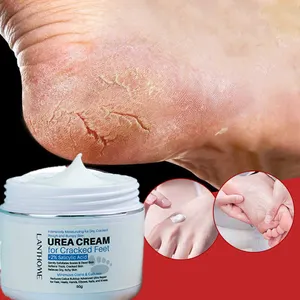 Tốt Nhất Callus Remover Urea Chân Chống Nứt Kem Loại Bỏ Da Chết Và Khô Giữ Ẩm Tay Kem Chân