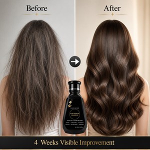 Shampoo allo Zenzero con Caffeina e Aminoacidi per la Crescita dei <span class=keywords><strong>Capelli</strong></span>, <span class=keywords><strong>Anti</strong></span>-<span class=keywords><strong>Caduta</strong></span>, Riparazione Profonda, Rafforzamento delle Radici, Risultati Visibili in 4 Settimane, per Adulti - Product Image 4
