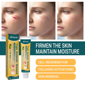 ครีมบำรุงผิว ximonth รอยแผลเป็นซีดจางช่วยบรรเ<span class=keywords><strong>ทา</strong></span>อาการถลอกผิว - Product Image 2