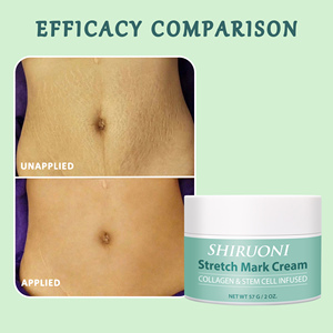 Crème Ventre Personnalisée Anti-Vergetures pour Femmes Enceintes au Thé Vert Exfoliante et Éliminatrice - Product Image 5