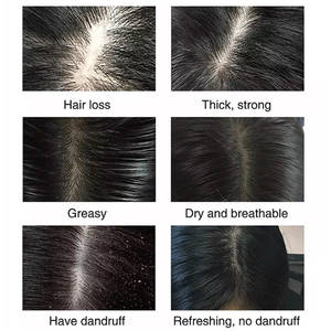 Champú Anticaída <span class=keywords><strong>Herber</strong></span> con Fórmula Natural, Aceite de Argán y Extracto de Raíz de Jengibre para Engrosar el Cabello, Precio de Fábrica - Product Image 5