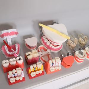 Modèle dentaire transparent de haute qualité, nouveau modèle d'affichage pathologique pour prothèses dentaires et implants - Product Image 2