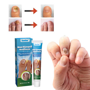Pied orteil <span class=keywords><strong>ongle</strong></span> champignon Anti fongique traitement des ongles onychomycose réparation pour infection fongique endommagée - Product Image 1