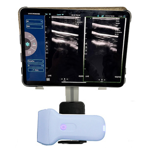 स्मार्ट फोन/एंड्रॉइड कंप्यूटर कनेक्ट वायरलेस यूएसबी जांच हैंडहेल्ड वायरलेस अल्ट्रासाउंड - Product Image 2