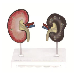 Perro <span class=keywords><strong>De</strong></span> ciencia médica, riñón saludable, riñón patológico, modelo <span class=keywords><strong>de</strong></span> <span class=keywords><strong>anatomía</strong></span>, estudio veterinario canino - Product Image 1