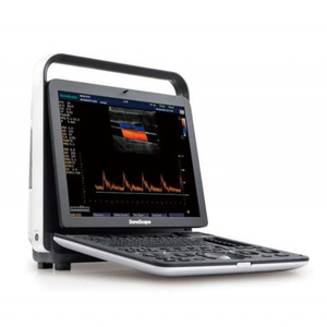 جهاز سونوسكيب E1 للتصوير بالموجات فوق الصوتية الملونة مع مسبار تي إي إي للأطفال - Product Image 1