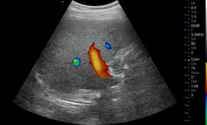 Wifi xách tay 128 yếu tố Mano không dây DOPPLER máy tính xách tay siêu âm đầu dò - Product Image 5