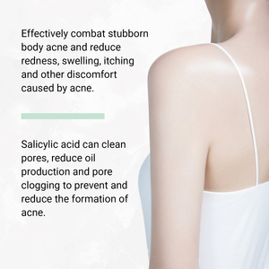 Spray de Tratamento para Acne nas Costas com 2% de Ácido Salicílico Ajuda a Reduzir Vermelhidão e Espinhas, Calmante para a Pele - Product Image 4