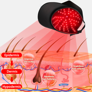 2025 Hot Sell Tragbare Shenzhen Idea Medical Grade Haarausfall behandlungs maschine von Wireless 850 660nm LEDs Rotlicht-Therapie kappe - Product Image 4