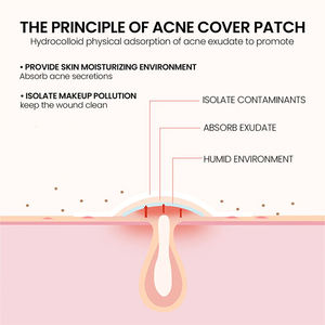 Patch anti-acné personnalisé imperméable avec aloe vera, collagène et vitamine C, hydratant, acide salicylique, hydrocolloïde - Product Image 5