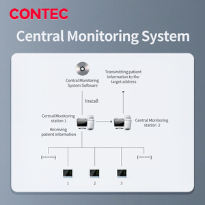 CONTEC CMS8000-1 ИБП ETCO2 многопараметрический монитор пациента для контроля за ambulancia для палаты интенсивного лечения жизненных функций пациента монитор - Product Image 5