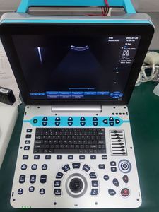Dawei Medical Abdomen Ginecología Neonatal Máquina de ultrasonido de diagnóstico 4D <span class=keywords><strong>5D</strong></span> Trolley Color Doppler Electricidad 19 pulgadas de alto - Product Image 2