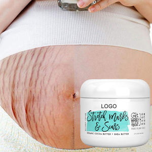 Crème réparatrice naturelle biologique à étiquette privée, anti-vergetures, réparation des vergetures, crème réparatrice des cicatrices, crème anti-vergetures de <span class=keywords><strong>grossesse</strong></span> - Product Image 1