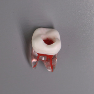 Đồ Dùng Giáo Dục Răng Rễ Nha Khoa Được Truy Cập Loại Nissin Có Khoang Bột Để Thực Hành Chế Độ Giải Phẫu Kiểu Nội Nha - Product Image 5