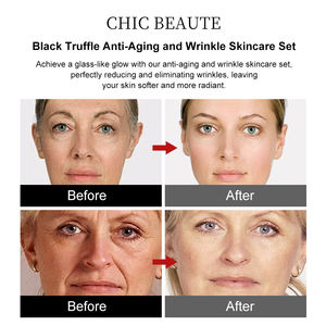 Set de Cuidado de <span class=keywords><strong>la</strong></span> Piel con Péptidos de <span class=keywords><strong>Trufa</strong></span> <span class=keywords><strong>Negra</strong></span> Premium Antienvejecimiento OEM de Bajo MOQ, Antiarrugas, Reparador e Iluminador, Nivel <span class=keywords><strong>SPA</strong></span> - Product Image 3
