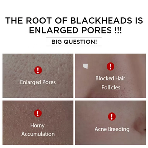 Niacinamide 10% Zinc 1% เซรั่มหน้านิโคตินสำหรับผิวมัน - Product Image 5