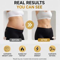 Cápsulas Keto Inteligentes para Pérdida de Peso al por Mayor OEM/ODM, Cetonas BHB, Garcinia Cambogia, Quemagrasas, Impulso de Energía, 60 Cápsulas