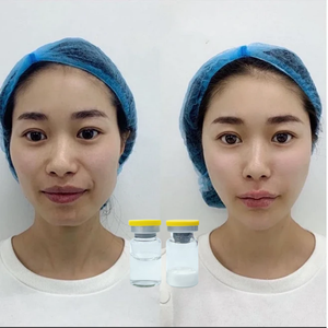 Siero Viso Rimpolpante con Acido Polilattico, Trattamento Micro-Infusione, Lifting Viso a V, Polveri Liofilizzate, Fiale di Collagene - Product Image 5