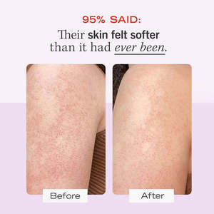 Gommage Corporel Anti-Imperfections 10% AHA Exfoliant Kératose Pilaire Poils Incarnés Acide Glycolique Aloe Vera Lisse Peau Rugueuse Marque Privée - Product Image 4