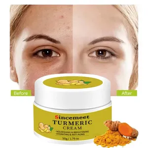 Cuidados com creme facial OEM removendo manchas escuras tratamento anti-acne creme de vitamina C creme de cúrcuma