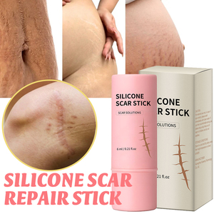 Güçlü etkili özel etiket doğal streç işaretleri onarım sopa Anti doğum sonrası derin akne skar kaldırma onarım krem kadınlar için - Product Image 1
