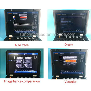 La Mejor Máquina de Ultrasonido Portátil Digital Completa de 15 Pulgadas, Ultrasonido <span class=keywords><strong>Doppler</strong></span> a Color Digital 3D - Product Image 5