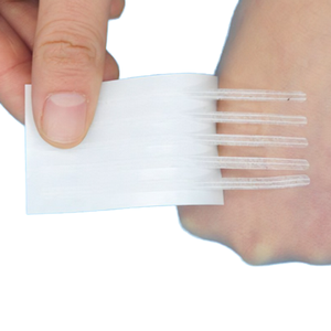 แถบกาวปิดแผลสำหรับผ่าตัดแผ่นรัดแผลทางการแพทย์ - Product Image 1