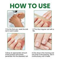 Sérum de Traitement Haute Qualité pour Mycoses des Ongles, Produits Réparateurs pour les Mycoses des Orteils, Gel de Soin Mains et Pieds, Anti-Onychomycose et Paronychie