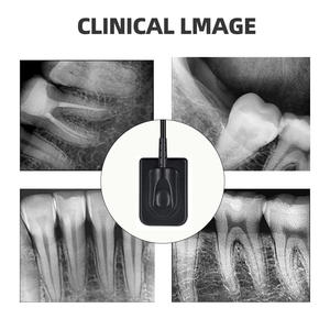 <span class=keywords><strong>Sensor</strong></span> RVG gigi untuk klinik gigi, <span class=keywords><strong>Sensor</strong></span> <span class=keywords><strong>Dental</strong></span> berguna <span class=keywords><strong>Sensor</strong></span> Oral Gigi, <span class=keywords><strong>sensor</strong></span> Rx <span class=keywords><strong>Dental</strong></span> - Product Image 2