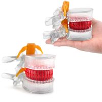 Modelo Anatómico de Columna Vertebral con Hernia Discal Lumbar 1.5X Tamaño Real, Herramienta Médica para Aprendizaje y Enseñanza, CE/ISO