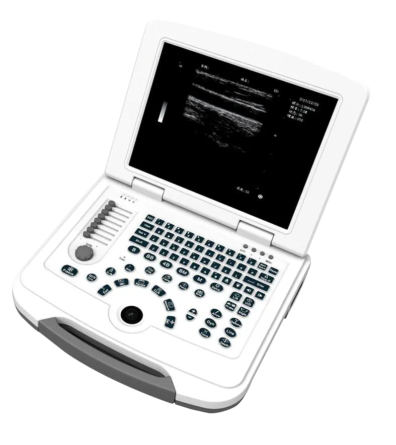 Scanner d'ultrasons Portable, Doppler de couleur avec batterie, certification CE ISO, acheter des machines à ultrasons