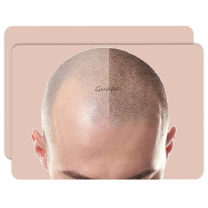 Nueva llegada Hombre/Mujer Cuero cabelludo Micropigmentación Práctica Piel SMP Cuero cabelludo <span class=keywords><strong>Tatuaje</strong></span> Piel para entrenamiento de micropigmentación calva - Product Image 1