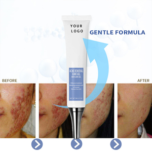 Label privé 20G Gel <span class=keywords><strong>de</strong></span> traitement <span class=keywords><strong>pour</strong></span> l'élimination <span class=keywords><strong>de</strong></span> l'acné végétalien Gel <span class=keywords><strong>pour</strong></span> soins <span class=keywords><strong>de</strong></span> <span class=keywords><strong>la</strong></span> <span class=keywords><strong>peau</strong></span> contre l'acné - Product Image 5