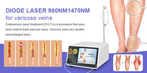 Perawatan Varises dengan Laser TRIANGEL 980nm EVLT Fiber Laser Mesin Laser 1470nm - Product Image 4