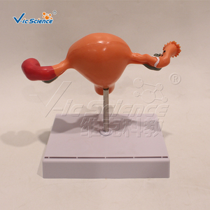 Modèles d'utérus normaux <span class=keywords><strong>et</strong></span> pathologiques, sciences médicales, modèles d'éducation en pathologie de l'utérus, modèles anatomiques <span class=keywords><strong>et</strong></span> scientifiques médicaux - Product Image 4