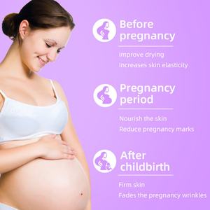 Autocollants personnalisés, crème anti-vergetures, soins de grossesse, produits pour femmes enceintes, produits de santé - Product Image 4